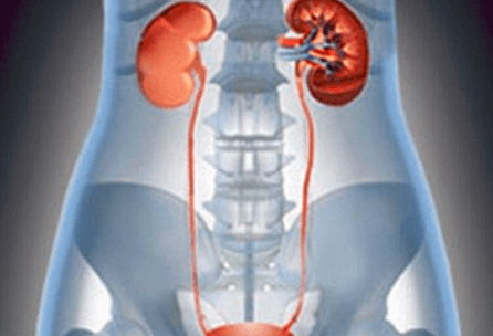 [힘이되는 건강정보] 극심한 통증의 요로결석을 예방하려면?